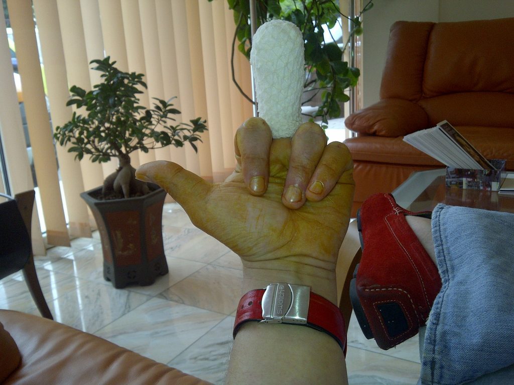 Florin Chilian operatie